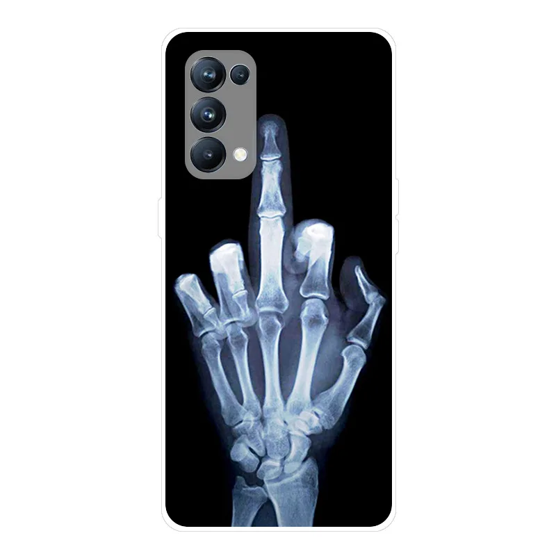 Funda trasera de silicona blanda para móvil, carcasa a prueba de golpes para OPPO Reno 5 Pro 5G, Reno 5G - imagen 3