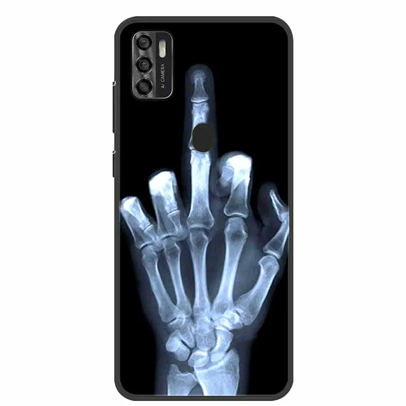 Para ZTE Blade A7s 2020 funda trasera de silicona suave para ZTE Blade A7s 2020 6,5 "funda para ZTE A7 S A7S A7020 Fundas - imagen 4