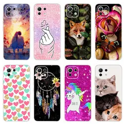 Xiaomi Mi 11 Lite Funda Dibujos Animados TPU Suave 6,55 pulgadas 5G