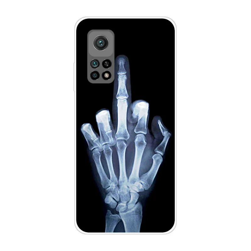 Funda trasera de silicona suave a prueba de golpes para Xiaomi Mi 10 T 5G, carcasa trasera de TPU para Xiaomi Mi 10 T Pro, fundas de teléfono para Xiaomi Mi 10 T 10 T - imagen 3