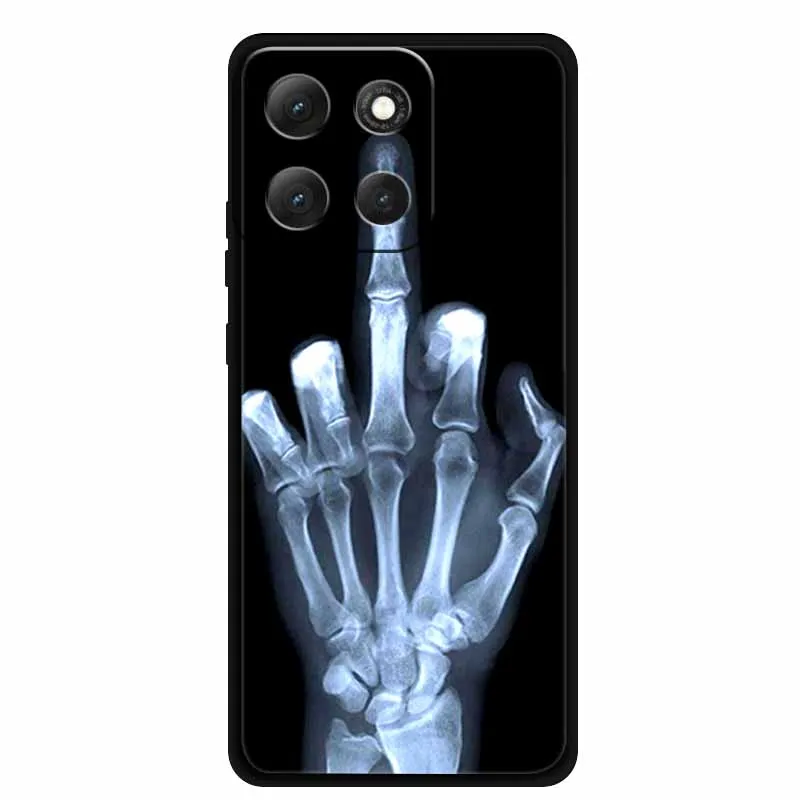 Para Moto G86 Power 5G funda animales silicona suave TPU fundas de teléfono para Motorola G86 Power a prueba de golpes Cool Wolf funda protectora - imagen 3