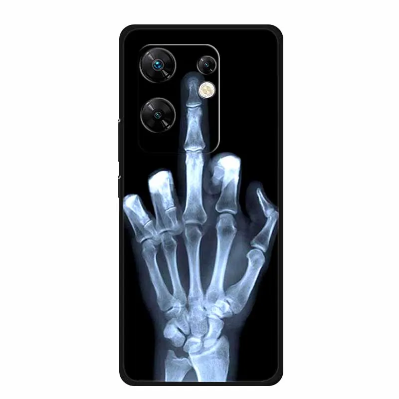 Para Infinix Zero 30 4G funda animales silicona suave TPU contraportada fundas de teléfono para Infinix Zero30 4G X6731B parachoques lobo Cool Coque - imagen 3