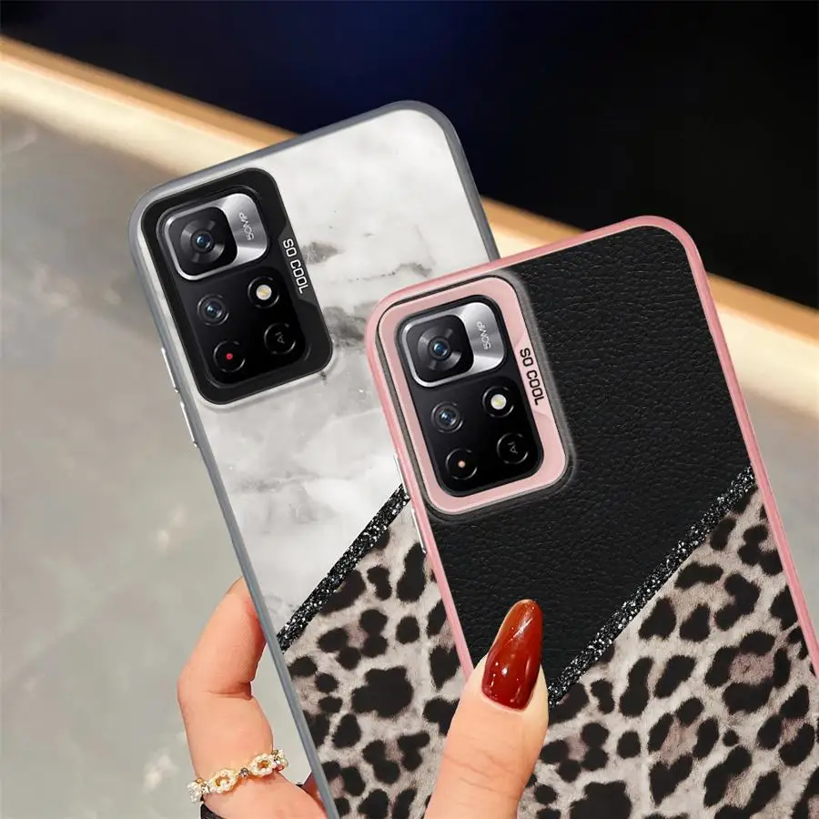 Funda trasera personalizada con estampado de leopardo para Xiaomi Mi 11 Lite 13T 12T Pro - imagen 3