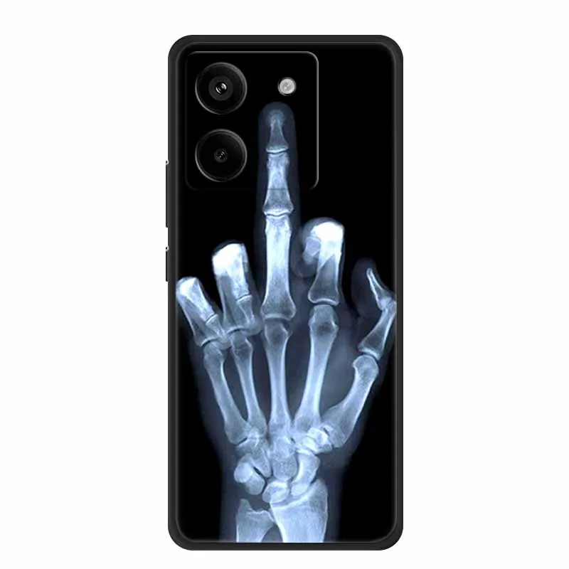 Para Xiaomi Poco M7 Pro 5G funda animales silicona suave TPU Fundas de teléfono contraportada para PocoM7 Pro Fundas protectoras a prueba de golpes para gatos - imagen 4