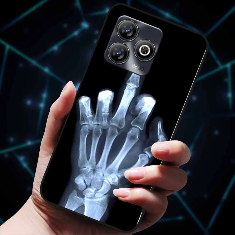 Para TCL 20 Pro 5G fundas de moda suave TPU fundas traseras de silicona para TCL 20Pro 5G funda trasera de gato de dibujos animados Coque parachoques TCL20Pro T810H - imagen 5