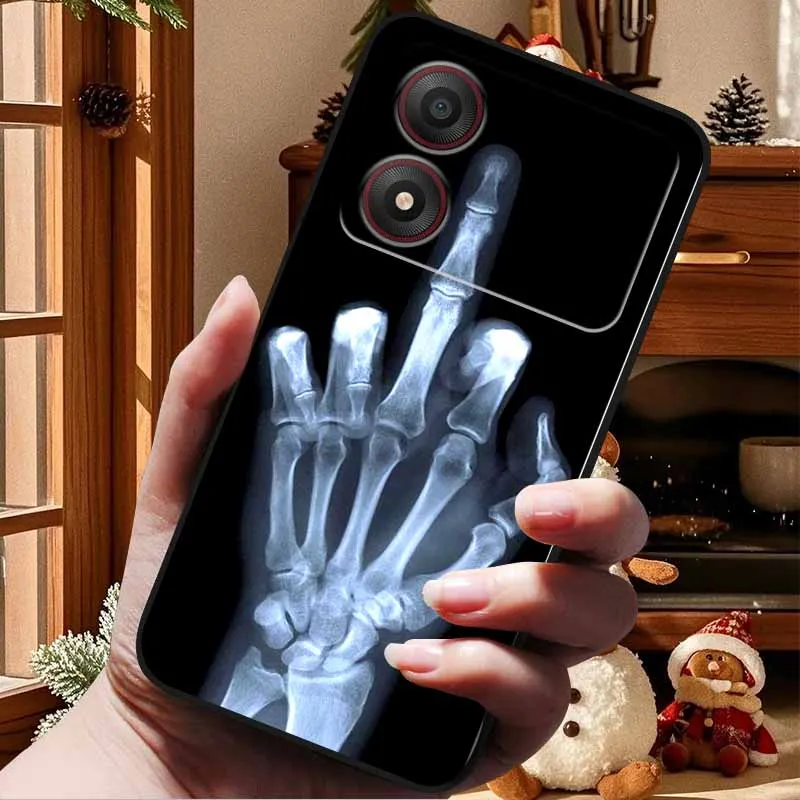 Para ZTE Blade A34 4G Funda de moda de lujo TPU silicona suave a prueba de golpes fundas de teléfono para ZTE Blade A 34 Funda para BladeA34 Capa - imagen 5