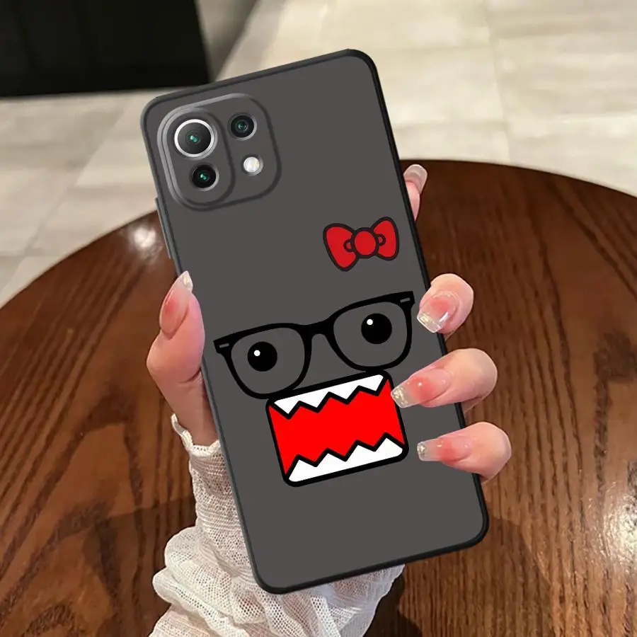 Funda de teléfono suave negra para Xiaomi Mi 11 12 13 Lite 10T 11T 12T Pro 13 14 15 Pro 12X emoticonos de pareja de dibujos animados - imagen 3