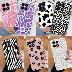Funda Honor X6B / X8B / 200 / X70 Lite – Silicona Leopardo Antigolpes