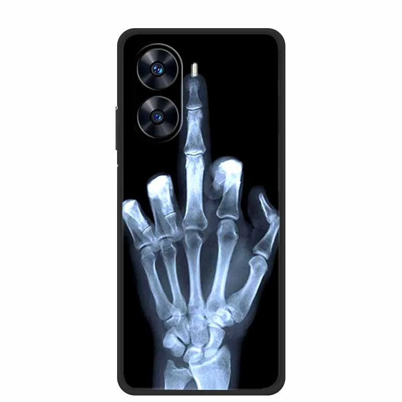 Para Xiaomi Poco X7 Pro 5G funda animales silicona suave TPU fundas de teléfono contraportada para PocoX7 Pro X7Pro Capa protectora a prueba de golpes - imagen 4