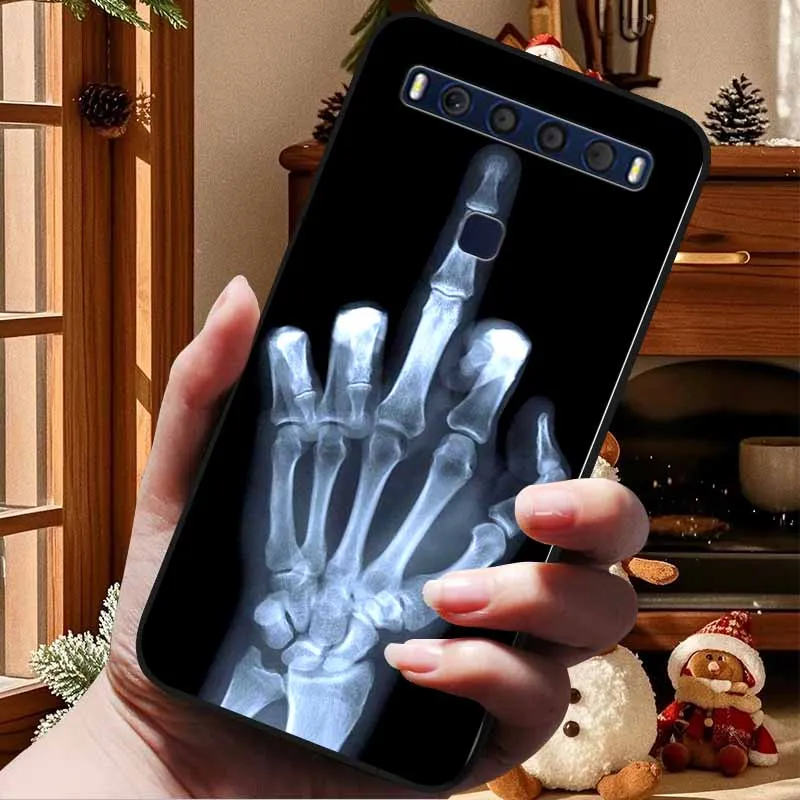 Para TCL 10 Pro Fundas suaves de silicona TPU gato León Fundas traseras para TCL 10 Pro T799B T799H Funda a prueba de golpes Funda Capa TCL10Pro 6,47" - imagen 2