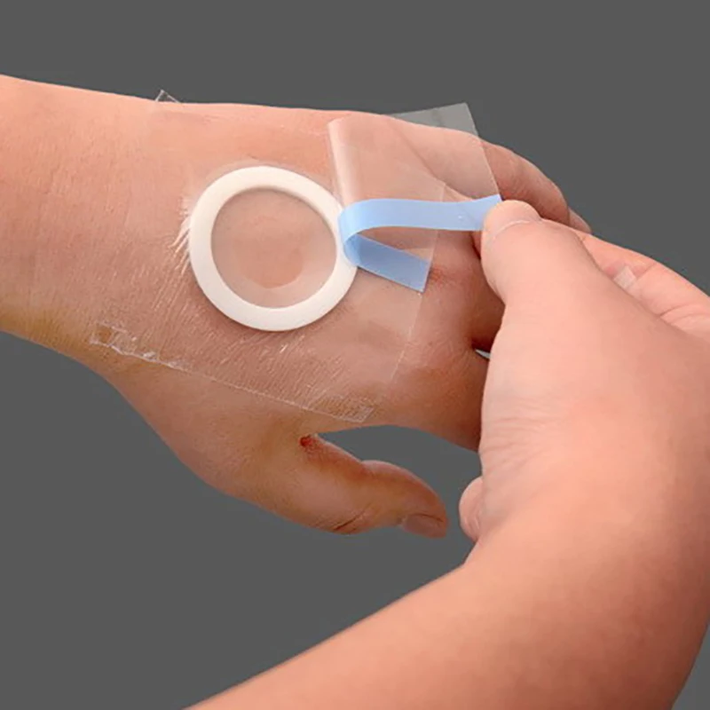 100 Uds cinta adhesiva médica impermeable cinta transparente PU antialérgico vendaje Medicinal para heridas cinta de fijación - imagen 3