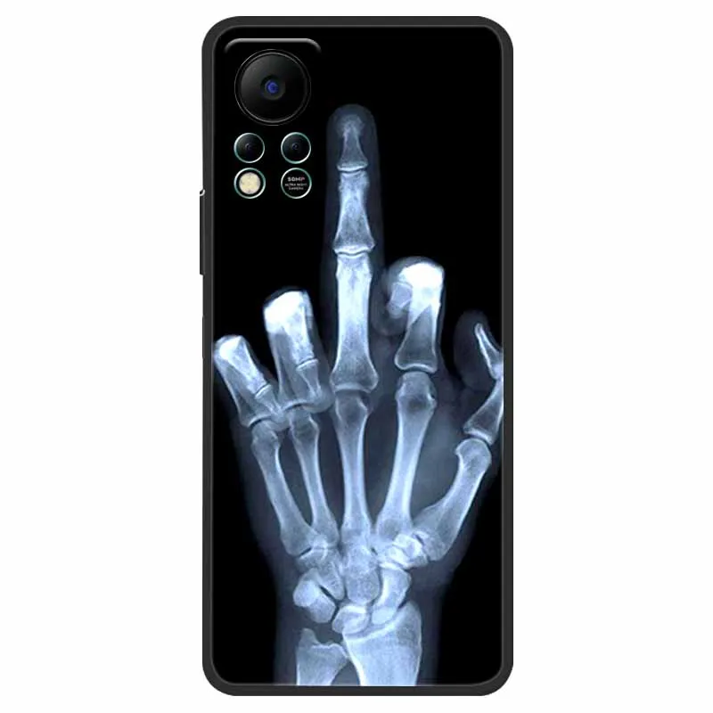 Funda trasera de silicona suave a prueba de golpes para Infinix HOT 11S, NFC, HOT11S, NFC, lindo, X6812B - imagen 5