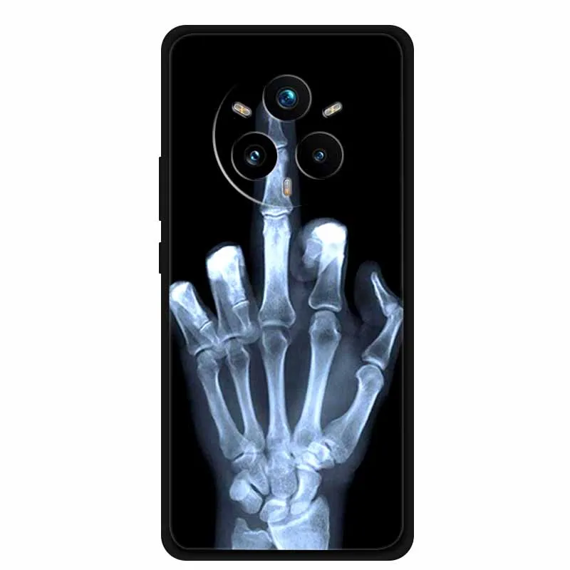 Para Realme P3 Pro 5G funda animales silicona suave TPU Fundas de teléfono contraportada para OPPO RealmeP3 Pro Fundas protectoras a prueba de golpes - imagen 4