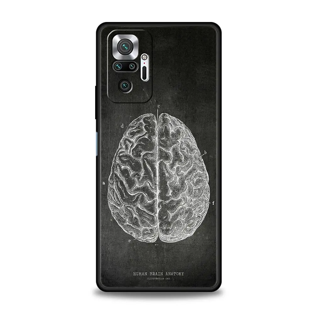 Funda Silicona Xiaomi Redmi Note 13 Pro Antigolpes Diseño Pizarra - imagen 4