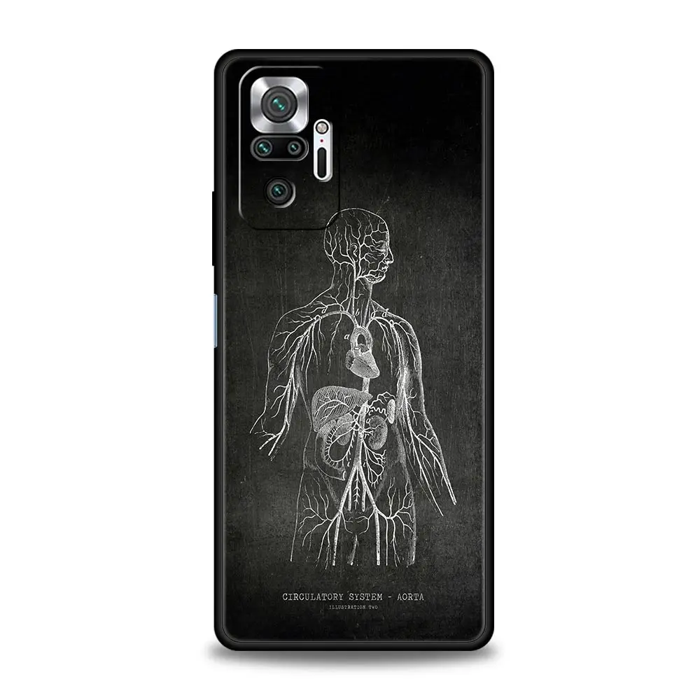 Funda Silicona Xiaomi Redmi Note 13 Pro Antigolpes Diseño Pizarra