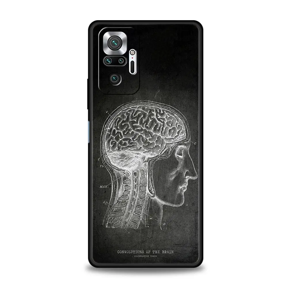 Funda Silicona Xiaomi Redmi Note 13 Pro Antigolpes Diseño Pizarra - imagen 2
