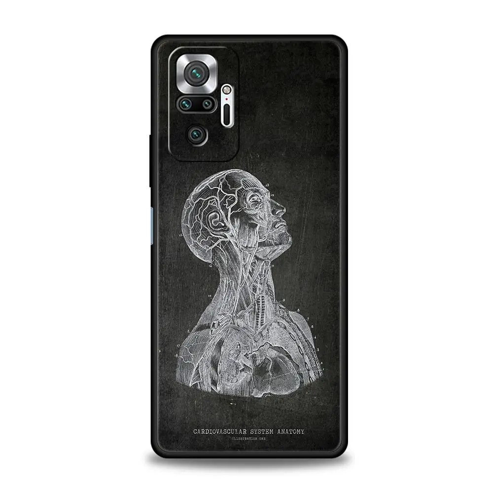 Funda Silicona Xiaomi Redmi Note 13 Pro Antigolpes Diseño Pizarra - imagen 3