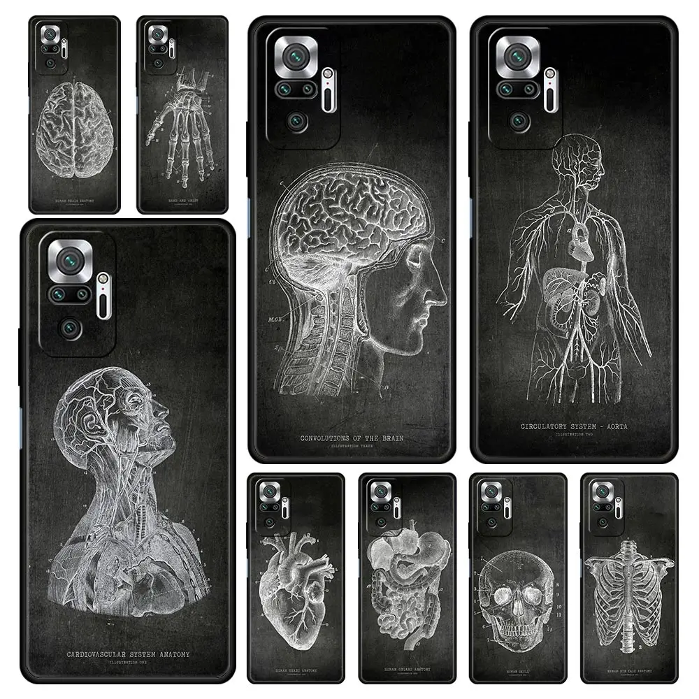 Funda Silicona Xiaomi Redmi Note 13 Pro Antigolpes Diseño Pizarra - imagen 5
